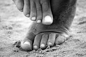What is adult Musculoskeletal Podiatry?